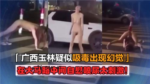 中路伪貌错觉、自慰、尿脂刺激